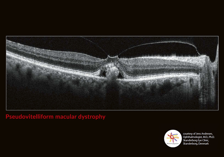 Going beyond the surface