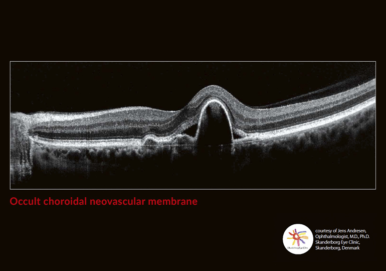 Going beyond the surface